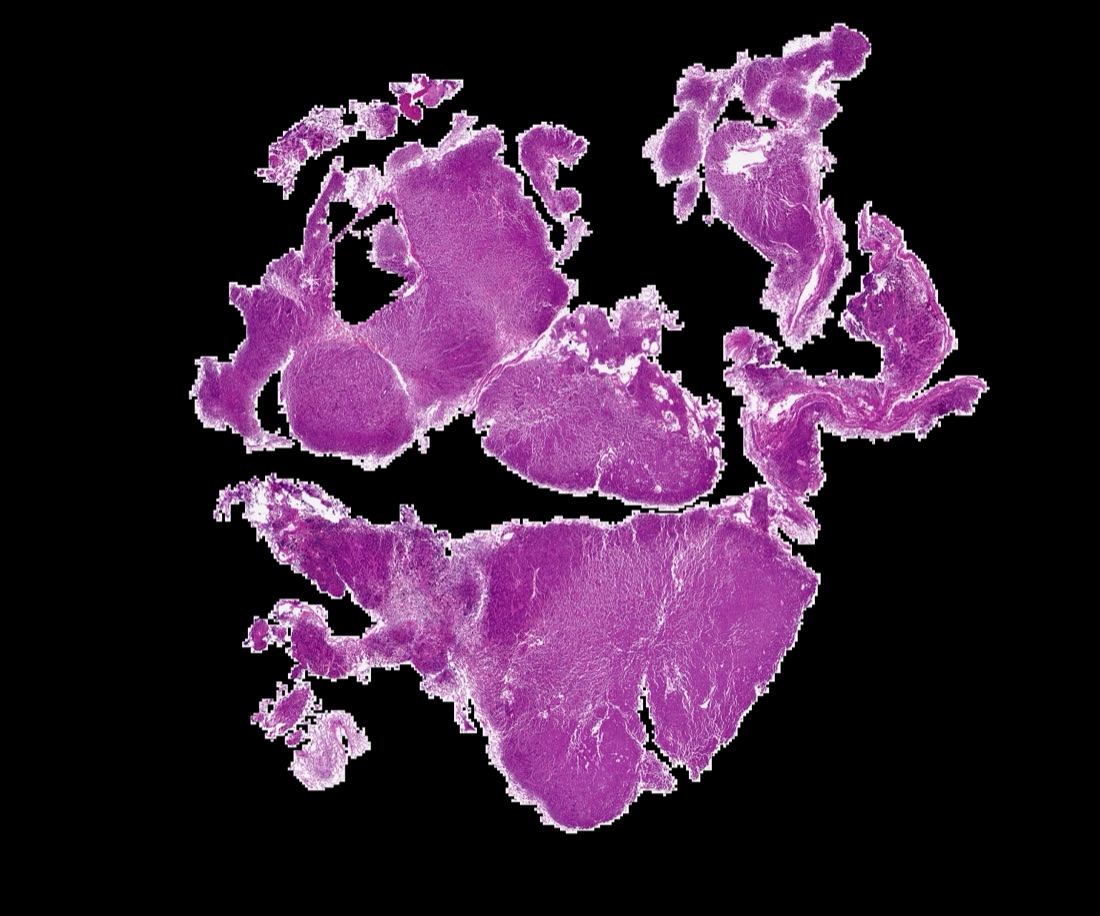 Hematoxylin and eosin stained pituitary whole-slide image